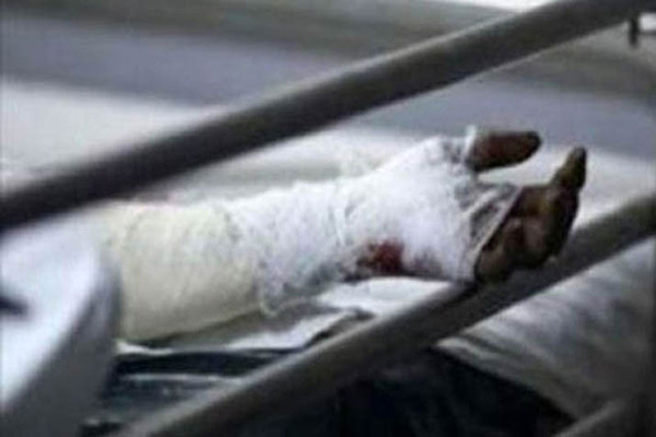 শ্বশুরবাড়ির শালিসে জামাইয়ের গায়ে পেট্রোল দিয়ে আগুন ।।