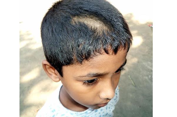 ঝালকাঠীতে ২০ শিশুর এক গোছা করে চুল কেটে দিলেন শিক্ষক ।।