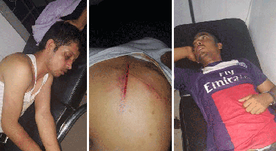 টেকনাফে ৫ সাংবাদিকের ওপর হামলা ঘটনায় ১৯ ইয়াবা ব্যবসায়ীর বিরুদ্ধে দ্রুত বিচার আইনের মামলা....