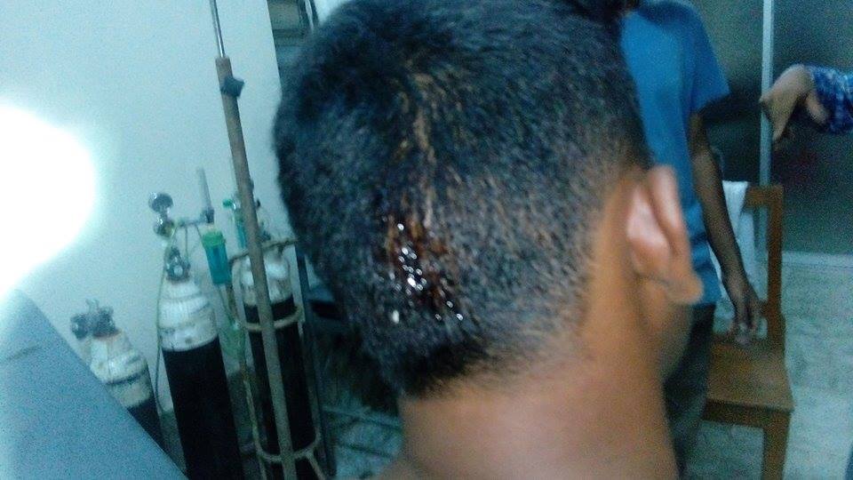 সন্ত্রাসী হামলায় রাজশাহী বিশ্ববিদ্যালয়ে ছাত্রলীগ কর্মী সহ সাংবাদিক আহত....