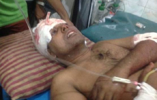 মাদারীপুরে কলেজ শিক্ষককে হত্যাচেষ্টার ঘটনায় পুলিশের মামলা