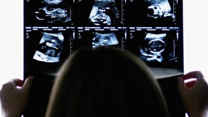 উত্তম সন্তান'জন্মদানে ভারতে আরএসএস এর প্রকল্প।।