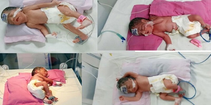 নোয়াখালীতে একসঙ্গে ৪ সন্তানের জন্ম দিলেন এক প্রসূতি॥