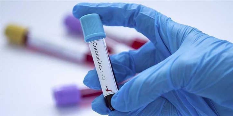 একদিনে করোনা আক্রান্তের সর্বোচ্চ রেকর্ড মক্কায়॥