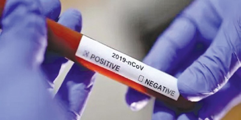 যুক্তরাষ্ট্রে করোনা সনাক্তে রেকর্ড॥ একদিনেই ৩৯ হাজার নতুন রোগী