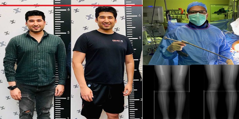 দুই ইঞ্চি উচ্চতা বৃদ্ধিতে খরচ ৬৩ লাখ টাকা