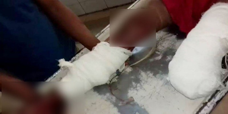 সিংড়ায় উপজেলা আঃ লীগ নেতার বাম পা কেটে নিল প্রতিপক্ষরা।